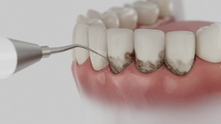 Reliable Tooth Extraction contractor in Gold River, CA by Smile Center Dentistry